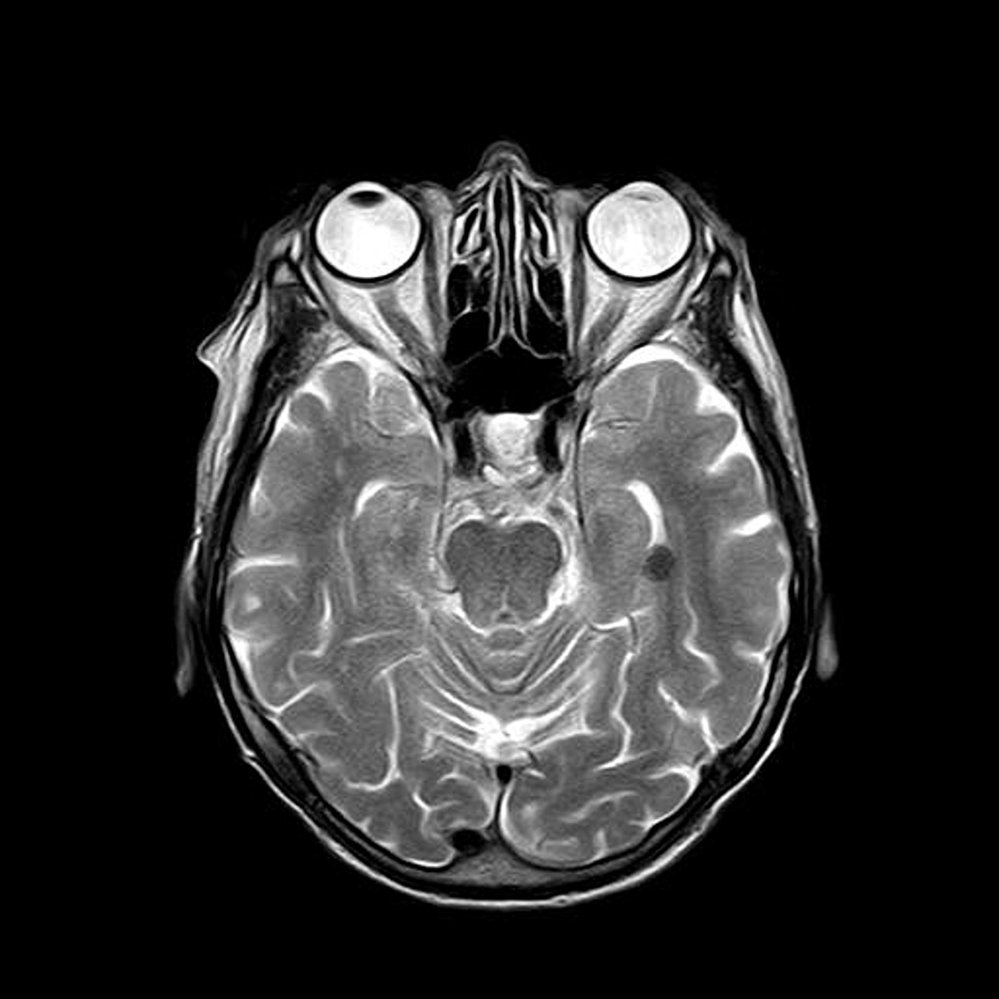 Magnetická rezonance zobrazuje  trojrozměrnou mapu činnosti mozku