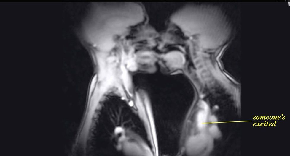 Magnetickou rezonancí zachycené líbání i pohlavní styk, je rozhodně zajímavé vidět