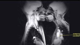 Magnetickou rezonancí zachycené líbání i pohlavní styk, je rozhodně zajímavé vidět