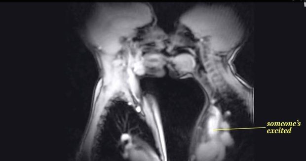 Magnetickou rezonancí zachycené líbání i pohlavní styk, je rozhodně zajímavé vidět