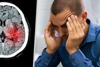 Záchranáři prozradili: Jak poznat nastupující mrtvici? Rozhodují minuty!