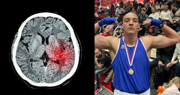 Boxer Václav utrpěl mrtvici už ve 21 letech. Něco takového nikdo nečekal.