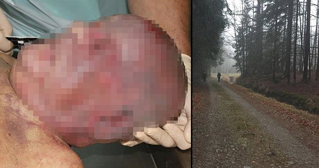 Policie zná totožnost mrtvého od Schwarzenberského kanálu: Pomohl jim umělý kyčel