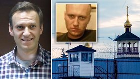Navalnyj má v ruské vězeňské kolonii otřesné životní podmínky. Experti mluví o mučení
