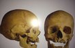 Slavkovská šibenice se nacházela na půli cesty mezi městem a Křenovicemi. Odborníci pod ní našli řadu kostí a také lebku popraveného muže ve věku 20 až 30 let, který trpěl zánětem zubů.