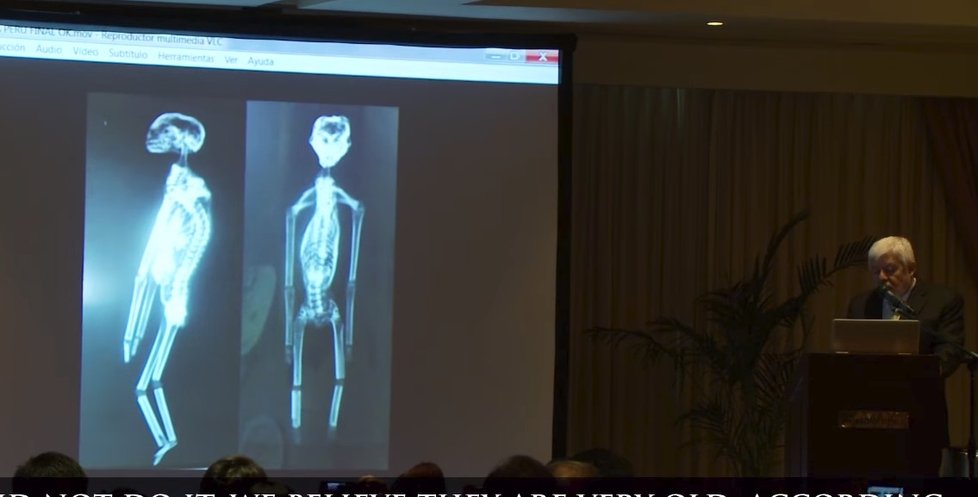 Na přednášce se promítaly rentgenové snímky.