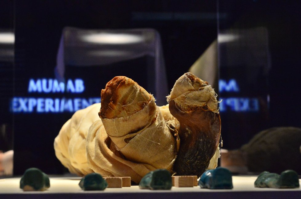 Mumie nemusejí být staré staletí, té nejmladší na výstavě je pouhých 24 let. Říká se jí MUMAB. Tělo původně patřilo muži, který jej věnoval na lékařské účely.