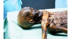 Nemocné mumie: Dávné stopy moderních neduhů