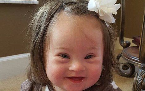 Emersyn Faith se narodila s Downovým syndromem.