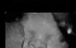 Obrázky z ultrazvuku jsou někdy poněkud děsivé...