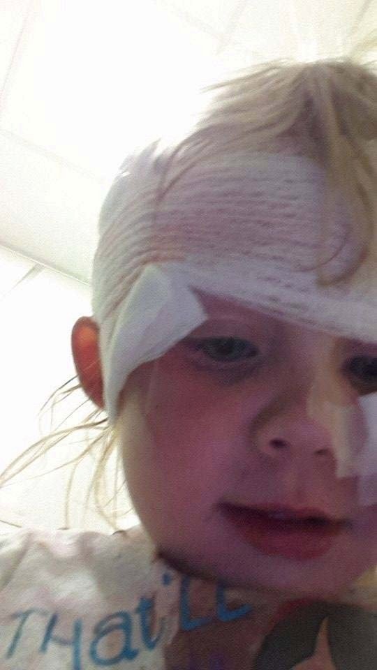 Takhle dopadla dvouletá holčička poté, co na ni spadla skříň z IKEI.