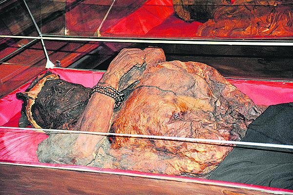 Nejzajímavějším nálezem z hlediska viditelných chorob je mumie Jodoka Fabritia z Paterbornu (1653, †50). Zaujme velikostí břicha, které není splasklé. CT vyšetření prokázalo, že dutina břišní je prázdná, lze se tedy domnívat, že byla vyplněna plynem, nejspíše při zauzlení střev. Tomu by odpovídal i další nález, nejspíše rakovinný nádor v oblasti konečníku.