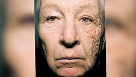 Slunce zdeformovalo řidiči náklaďáku levou stranu tváře: Tohle mu udělaly paprsky během 28 let