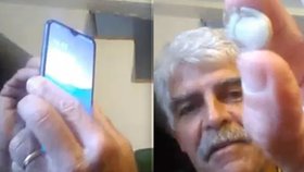Muž (56) při nehodě přišel o prst: Teď ho využívá k odemykání svého mobilu!