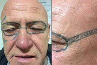 Kocovina s „raybankami“: Chlapík se po kalbě probudil s brýlemi vytetovanými na obličeji