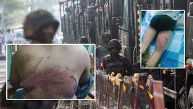 Známky mučení na barmských vězních po vojenském převratu.