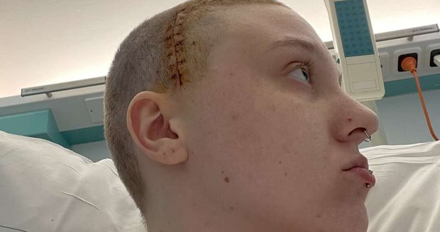 „Chci žít, milovat a smát se.“ Dvacetiletá Lucinka bojuje s agresivním nádorem mozku a prosí o pomoc s léčbou za 11 milionů