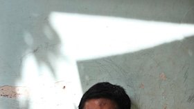 Herdi Firmansyah z Indonésie bojuje s obřím nádorem.