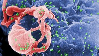 Akademie věd: Vir HIV vznikl před 60 miliony let