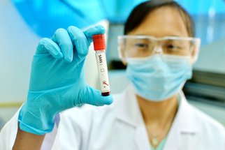 SARS: Jak se liší od koronaviru? Příznaky, projevy a léčba plicní nemoci SARS: Jak se liší od koronaviru? Příznaky, projevy a léčba plicní nemoci