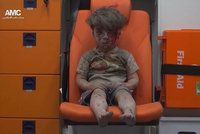 Srdceryvný symbol války v Sýrii: Zkrvavená tvář malého Umrána obletěla svět