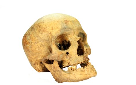 Věk, stáří a nakonec i identitu ženy odhalili ze zbytků skeletu.