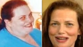 Nancy před a po té, co zhubla dvěstě padesát kilogramů.