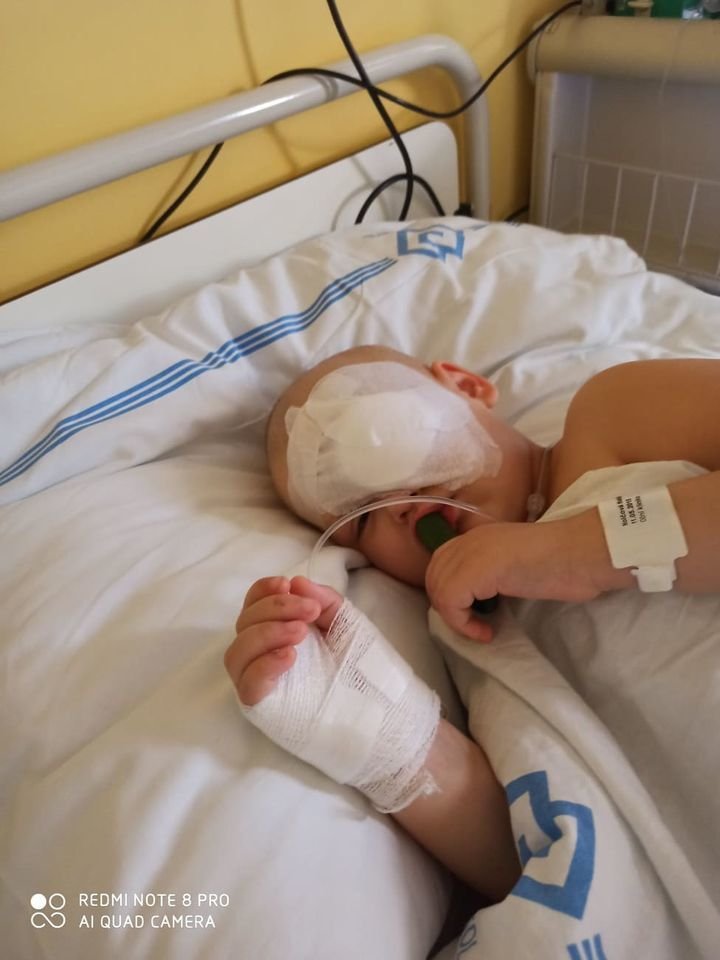 Malá Nanný (5) přišla kvůli rakovině o oko: Statečná bojovnice pořád nemá vyhráno