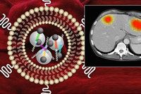 S léčbou rakoviny mají pomoci nanosenzory. Ukáží, jak se daří ničit nádory