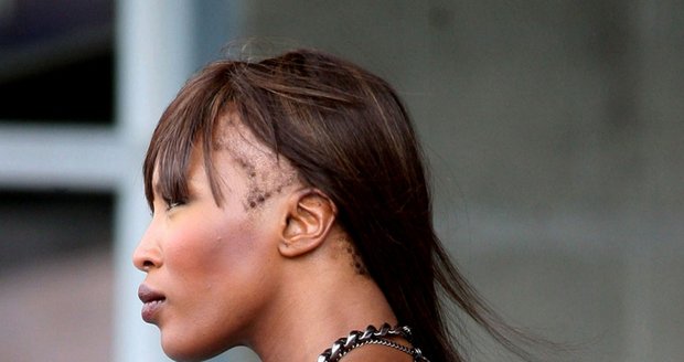 Naomi Campbell plešatí. Nemoc zvanou trakční alopecie způsobily časté úpravy vlasů