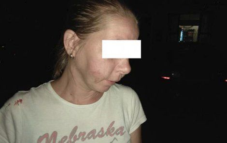 Žena měla tričko od krve, prokousnutou tvář a v žilách 3,5 promile alkoholu.