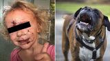 Holčičku (3) na Pardubicku brutálně pokousal pes: Rodina poslala dojemný vzkaz záchranářům
