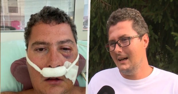 Po dovolené skončil v nemocnici: Ondřeje v Řecku zmlátili do bezvědomí!