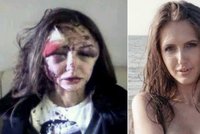 Milionář na útěku: Zmlátil přítelkyni tak, že vypadala jako zombie!
