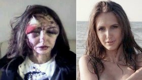 Takto dopadla ruská modelka po napadení svým přítelem.