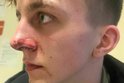 S nepochopitelnou brutalitou se setkal Michael (18) v sobotu ráno na pardubickém nádraží. Opilý securiťák (33) mu na peronu dal rány pěstí do obličeje. Prý jen proto, že si hvízdal.