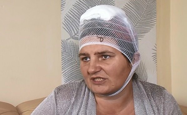 Martina Zadražilová se probudila zbitá ve vaně