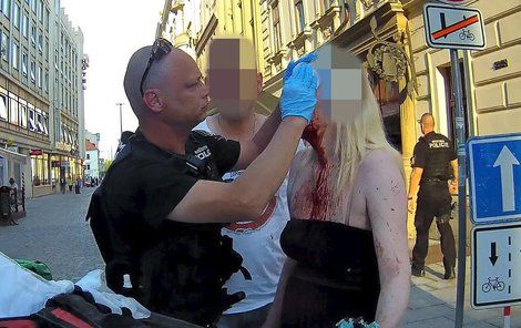 Zakrvácenou ženu museli ošetřit strážníci.