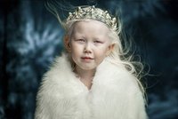 Zázrak přírody! Tato malá albínka se stala hitem internetu. Pochopíte proč! 