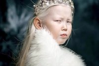 Nevšední krása: Albínka ze Sibiře se stala senzací internetu! 