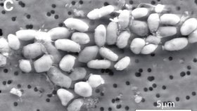 Tyto bakterie s arzenem v DNA byly objeveny v jezeře Mono