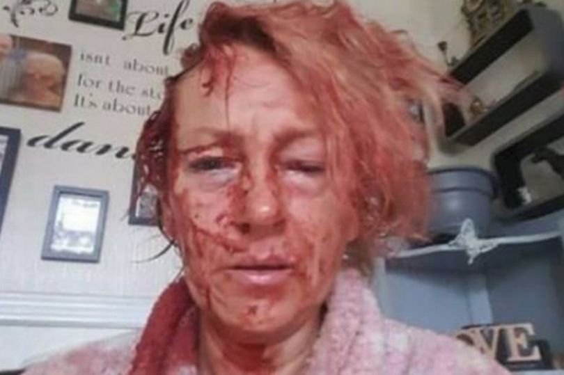 Násilník brutálně napadl ženu  zkrvavil jí obličej