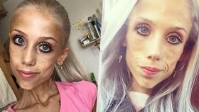 Natálie s anorexií bojovala osm let, zemřela ve 23 letech. Vážila jen dvacet kilo.