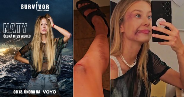 Natálie Kotková popsala natáčení znělky na Survivor