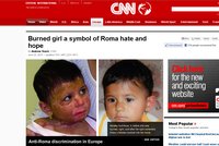 Brutální útok na Natálku 'proslavil' Česko v CNN