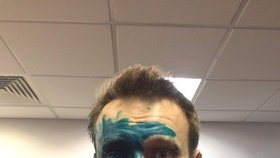 Navalného polili zelenou barvou a poleptali mu oko.