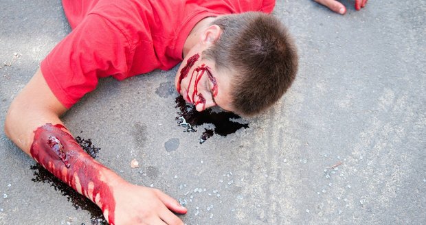 V Havířově neznámý řidič srazil cyklistu a od vážně zraněného muže ujel. Ilustrační foto