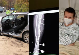 Lékaři staví Annu Ryšavou (29) z Uherského Hradiště po nehodě na nohy.