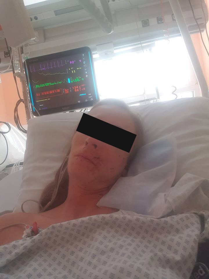 Simona Ševčáková (32) utrpěla při nehodě tramvaje a trolejbusu v Brně zlomeninu lícní kosti a posunula se jí i čelist.