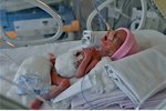 Bulharská lékařka porodila dcery Merry a Jacklyn